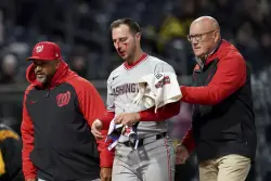 Nats’ Paul DeJong relieved his vision wasn’t affected by pitch to face that broke multiple bones